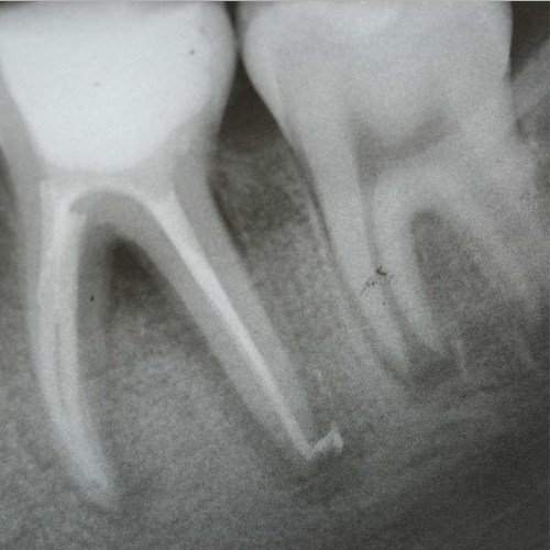 David G. Johnson DDS Endodontics Layton