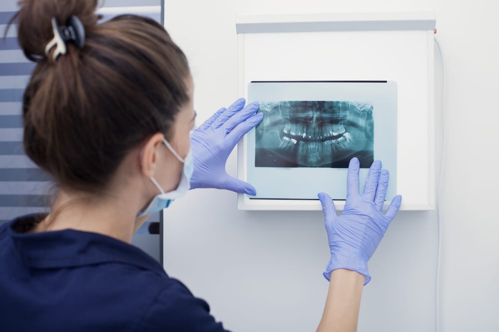3D imaging traditional dental x-ray